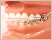 矯正歯科|埼玉県富士見市の歯医者